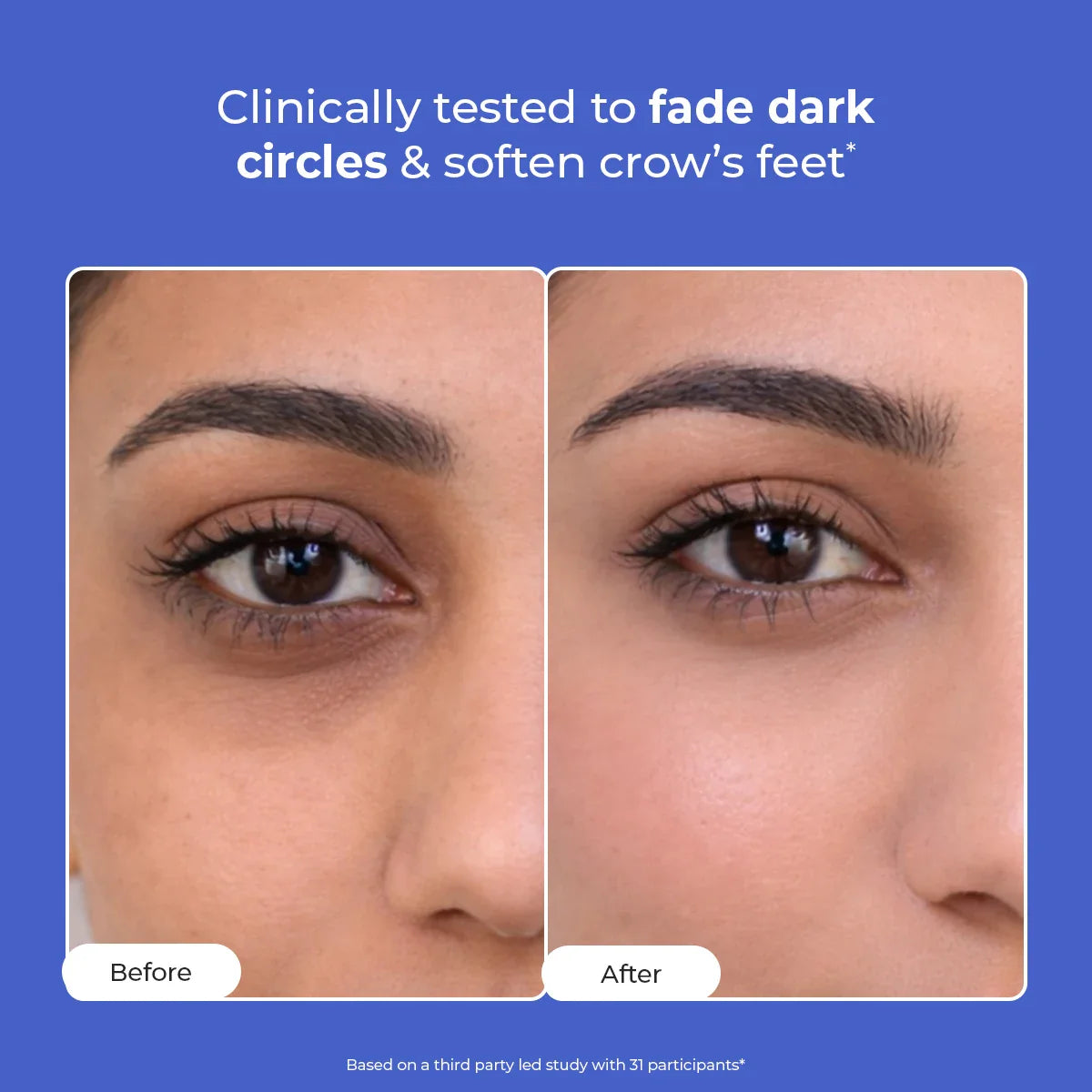 Retinol Peptide Eye Treatment Serum For Dark Circle
