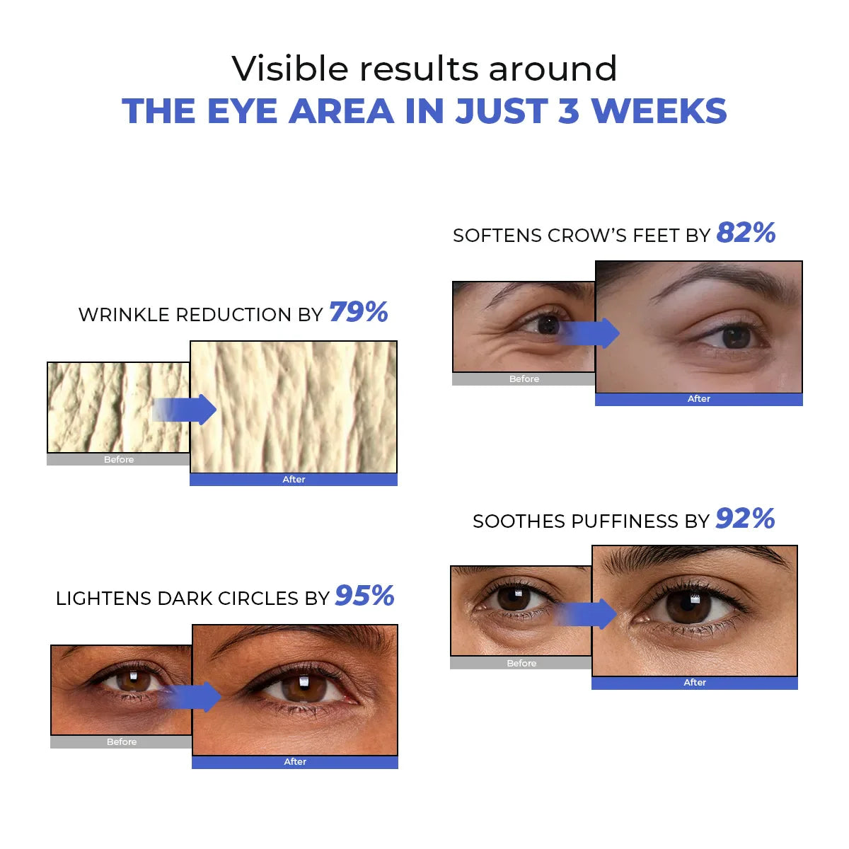 Retinol Peptide Eye Treatment Serum For Dark Circle